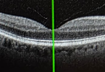 visual receptors